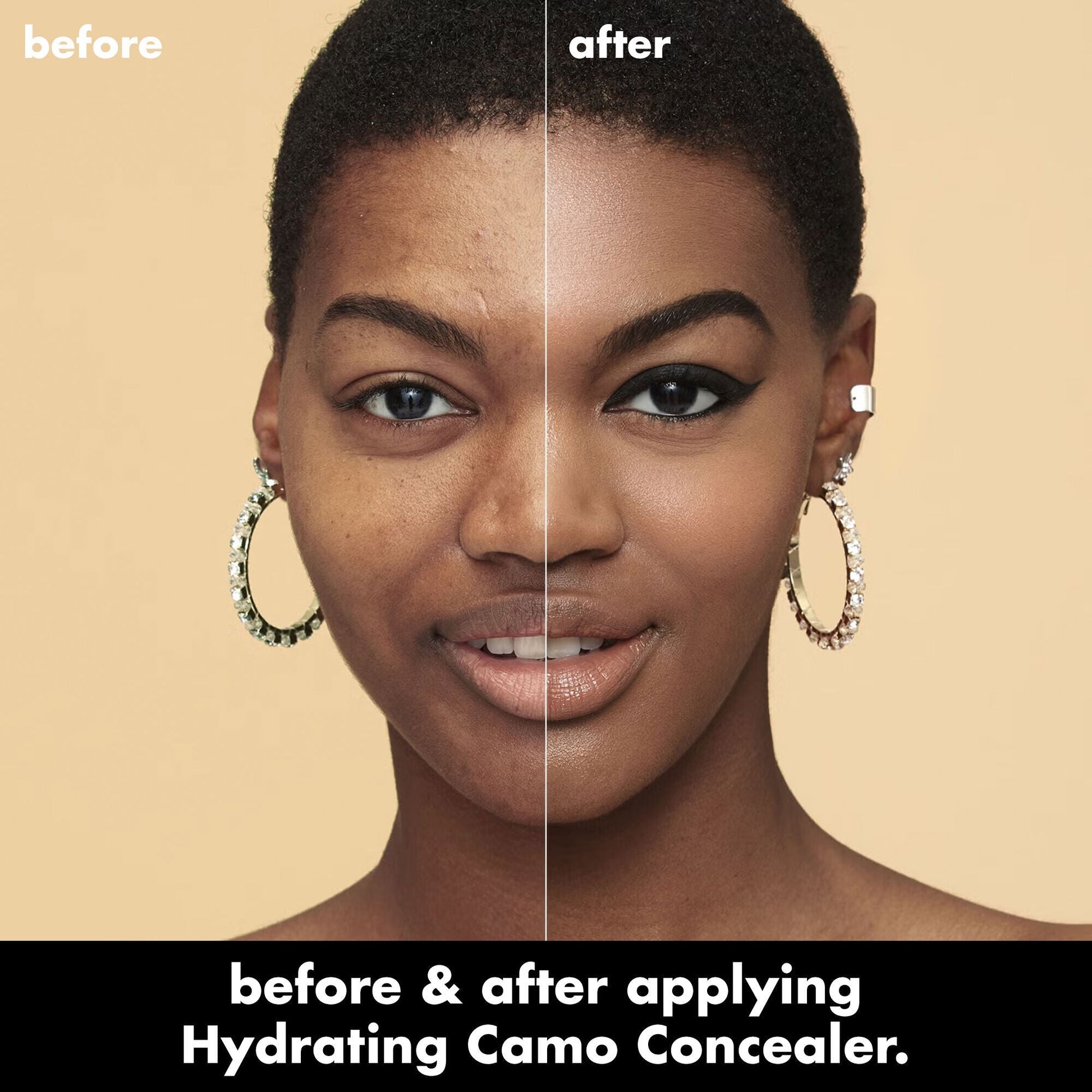 hydrating-camo-concealer-b3 0226_EDU_HydratingCamoConcelaer_BA_AshleyKaresh_20_1_d8499bbf-0e91-4173-b5e2-75127caf83a3.jpg