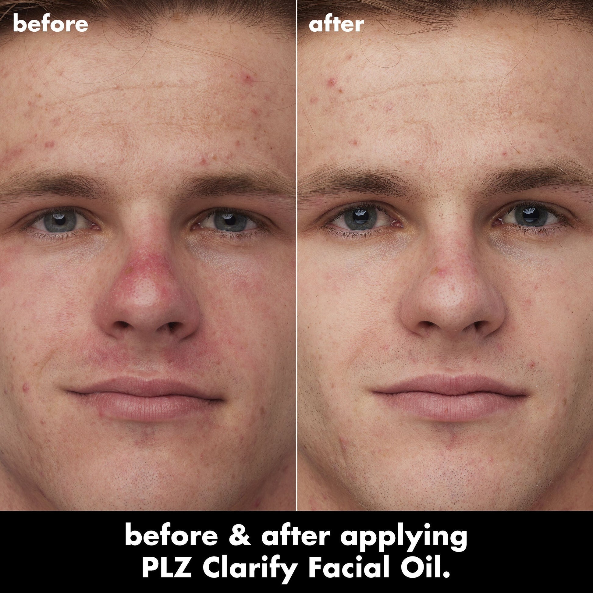 plz-clarify-facial-oil-m5 0326_EDU_PlzClarify_BA_Caleb.jpg