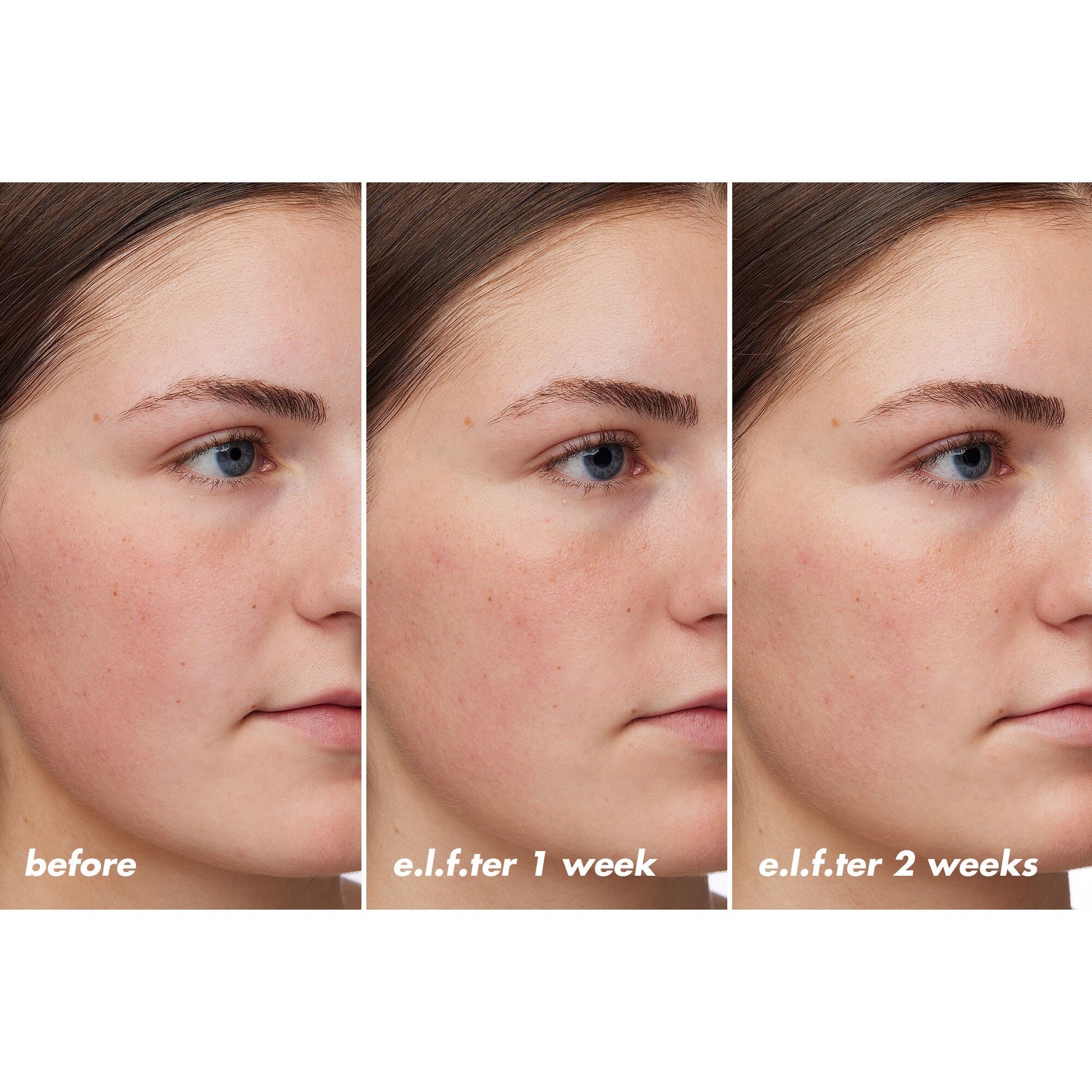 holy-hydration-barrier-goals-cream-regular-i3 XX26_EDUCATION_HH-BarrierGoals_B_A_Zoe_TRYPTICH_74c905bd-67bd-4b91-b633-2b01a8905cb8.jpg